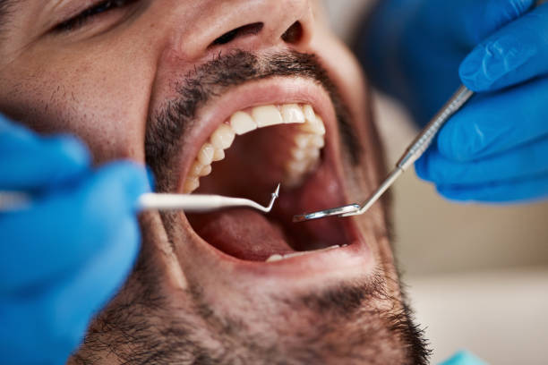 Best Cosmetic Emergency Dentistry in Lynchburg, VA