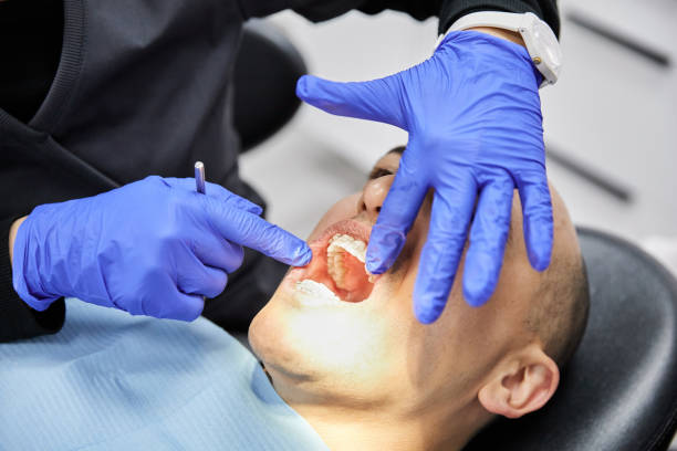 Best Emergency Tooth Extraction in Lynchburg, VA